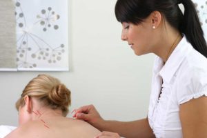 what does an acupuncturist do